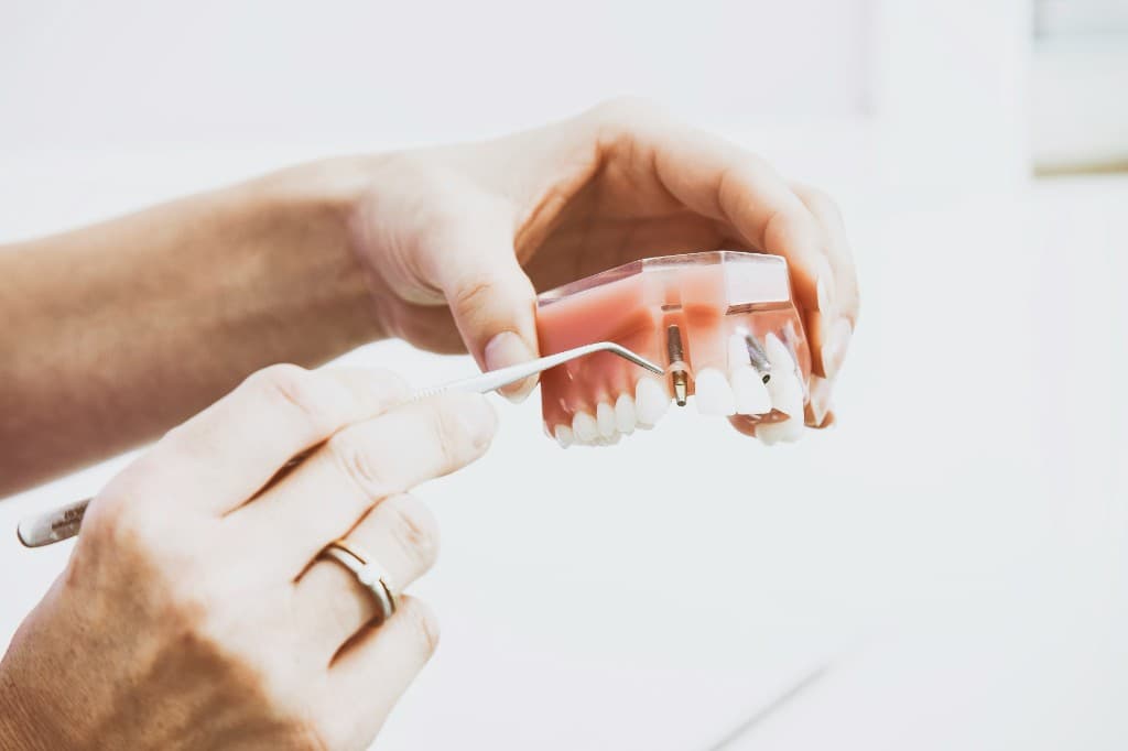 Dental Implants at Smile Bright Dental Westlands