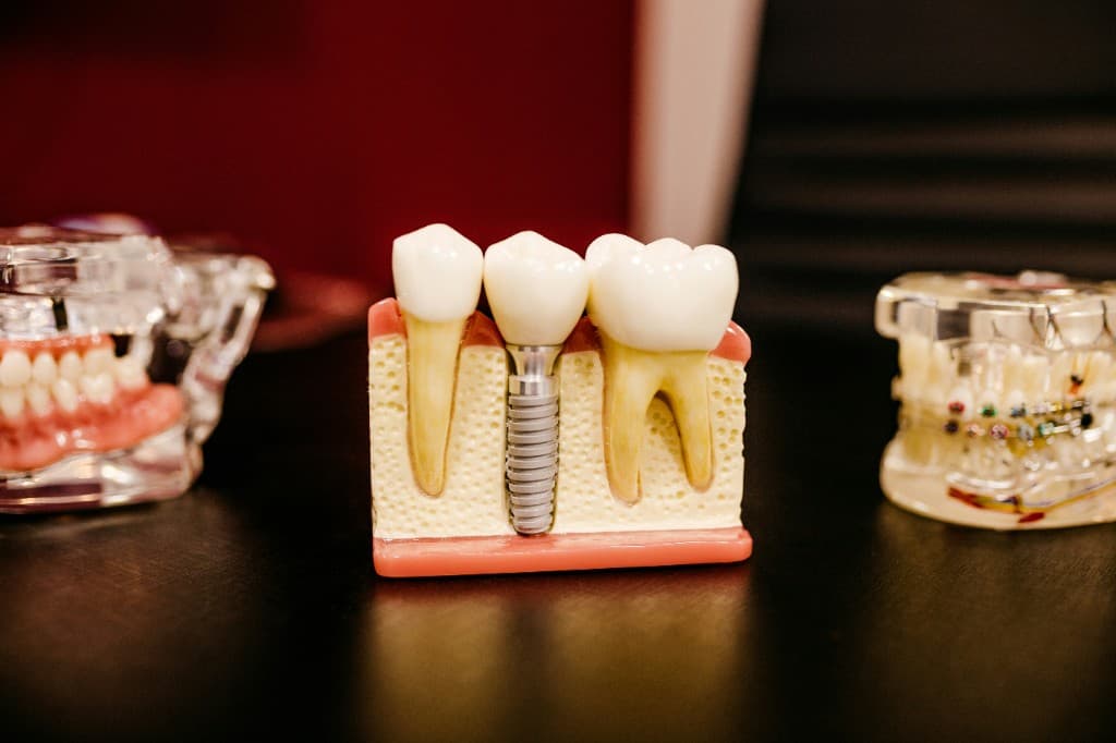 Orthodontics at Smile Bright Dental Westlands
